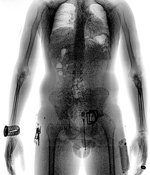 scan_torax