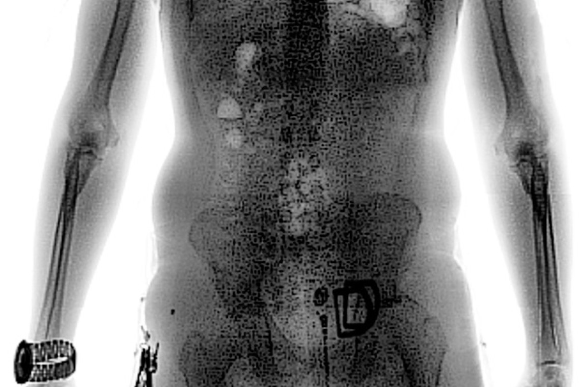scan_torax