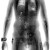 scan_torax